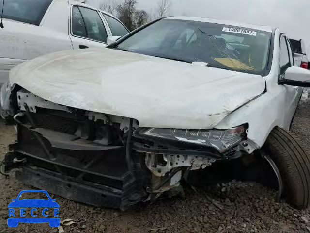 2015 ACURA TLX 19UUB1F34FA016760 image 1