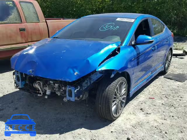 2017 HYUNDAI ELANTRA SP KMHD04LB5HU364565 image 1