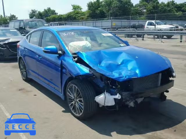 2017 HYUNDAI ELANTRA SP KMHD04LB3HU336909 image 0