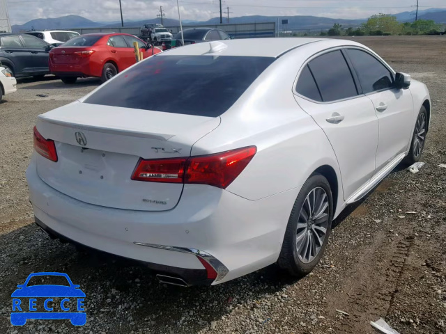 2018 ACURA TLX ADVANC 19UUB3F7XJA004118 Bild 3