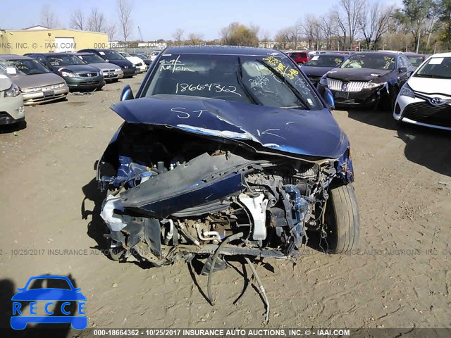 2016 Hyundai Accent SE KMHCT4AE3GU946582 image 5