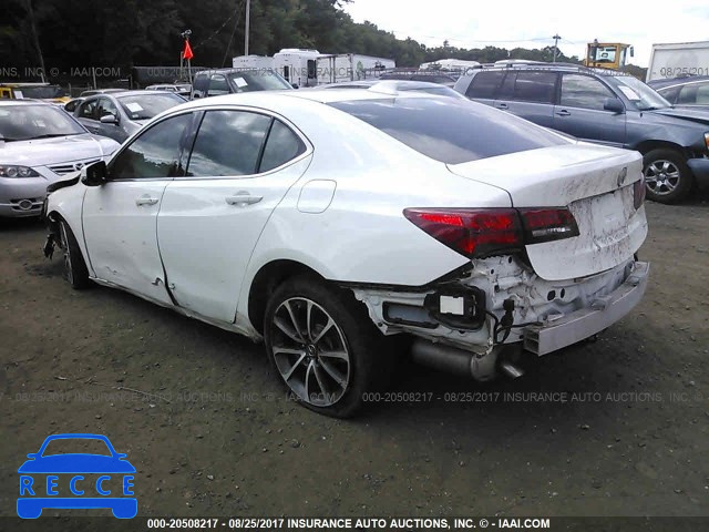 2015 Acura TLX 19UUB3F76FA006018 image 2