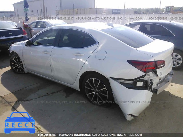 2015 Acura TLX ADVANCE 19UUB2F74FA002592 Bild 2