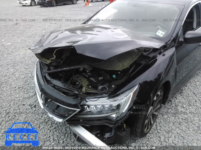 2018 ACURA ILX SPECIAL EDITION 19UDE2F48JA001788 image 5