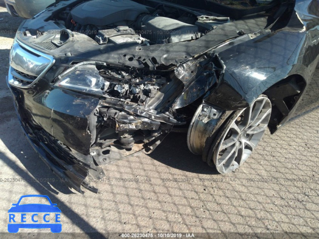 2015 ACURA TLX TECH 19UUB2F51FA023690 image 5