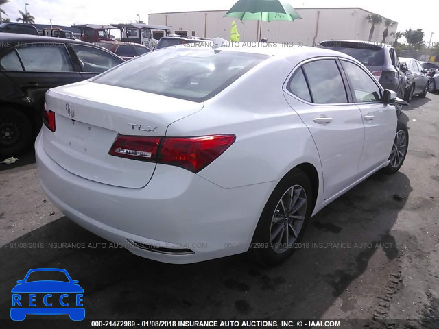 2018 ACURA TLX 19UUB1F32JA006625 image 3