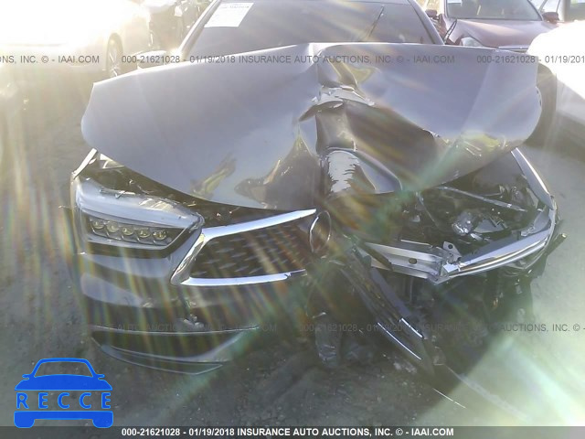 2018 ACURA TLX 19UUB1F37JA003588 Bild 5