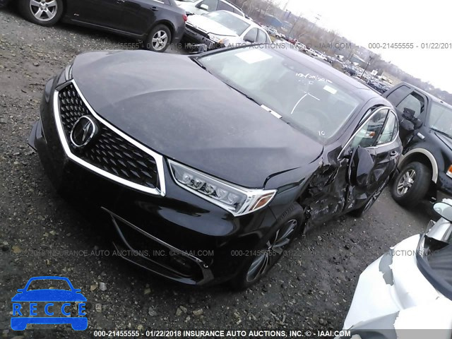 2018 ACURA TLX ADVANCE 19UUB3F76JA005086 image 1