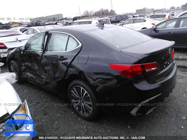 2018 ACURA TLX ADVANCE 19UUB3F76JA005086 image 2