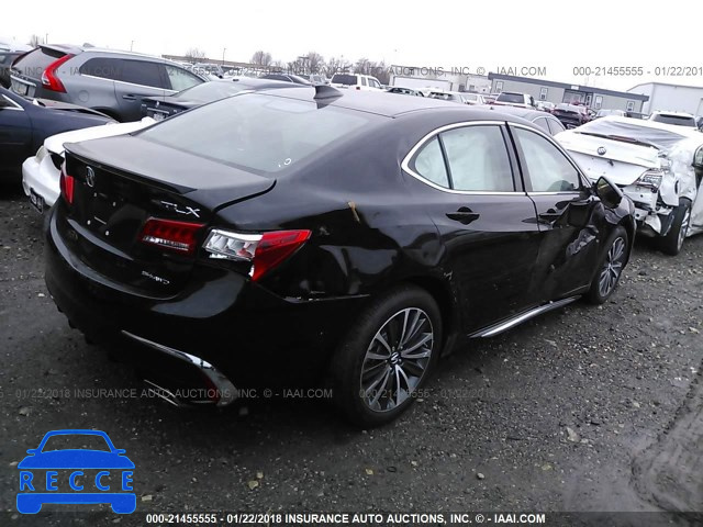 2018 ACURA TLX ADVANCE 19UUB3F76JA005086 Bild 3