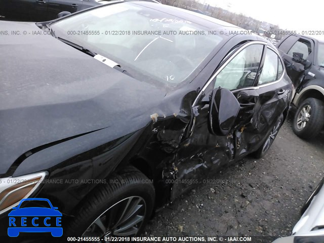 2018 ACURA TLX ADVANCE 19UUB3F76JA005086 Bild 5