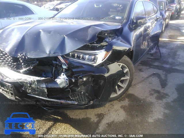 2018 ACURA TLX TECH 19UUB1F52JA003399 зображення 5