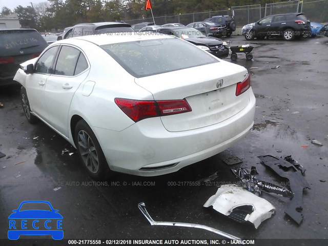 2018 ACURA TLX 19UUB1F3XJA006632 image 2