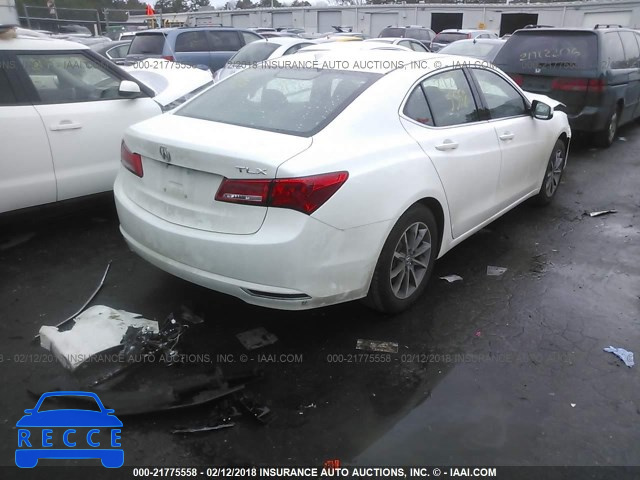 2018 ACURA TLX 19UUB1F3XJA006632 image 3